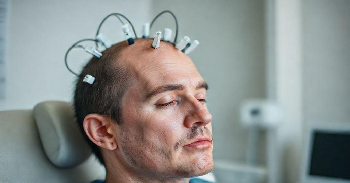 Exame de EEG: Guia Completo para a Saúde Cerebral