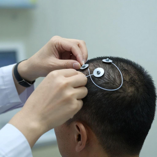 Eletroencefalograma: O que é e Como Contribui para a Saúde do Cérebro